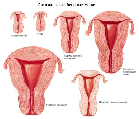 Матка