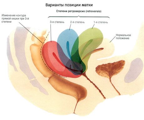 Матка
