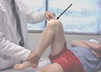 Болката в коляното по време на флексия е най-честата причина, поради която хората посещават лекари по травма. 
