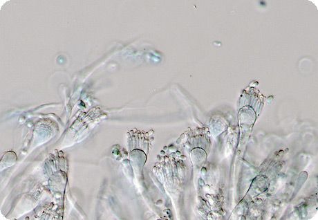 Една от гъбите от рода Aspergillus