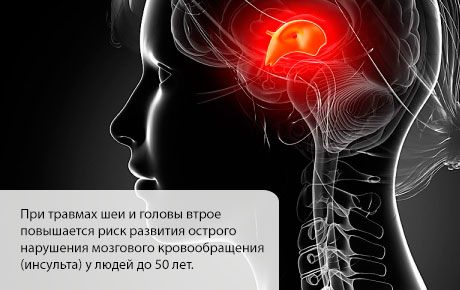 Рискът от инсулт се увеличава през първите месеци след травма на главата или шията